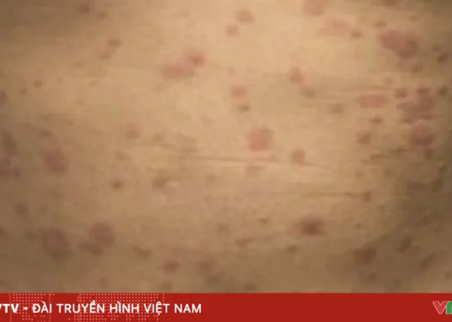 Bokep Viral Indo Interaksi ngentot tak memakai perlindungan meraih menyebabkan ditemukannya infeksi ganda sifilis dan HIV.